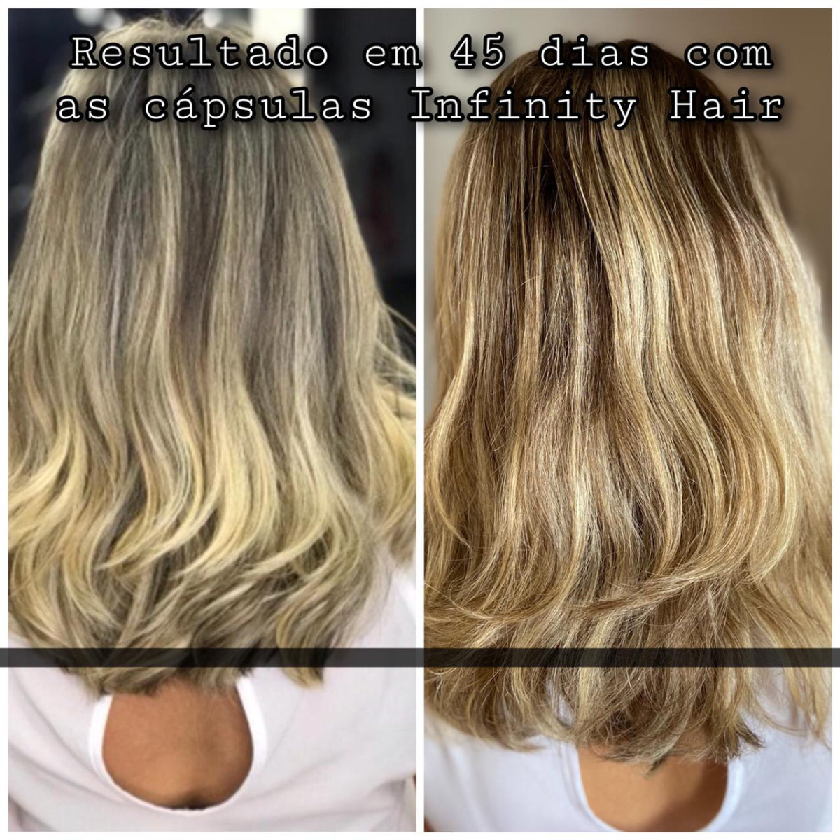 Kit Crescimento Infinity Hair Completo 250g