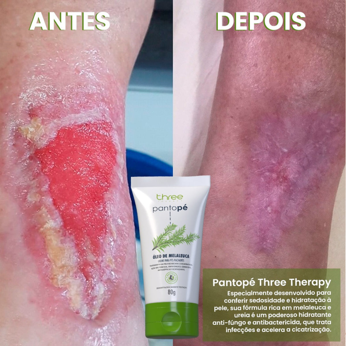 Pantopé Sachê 15g (1 unidade)